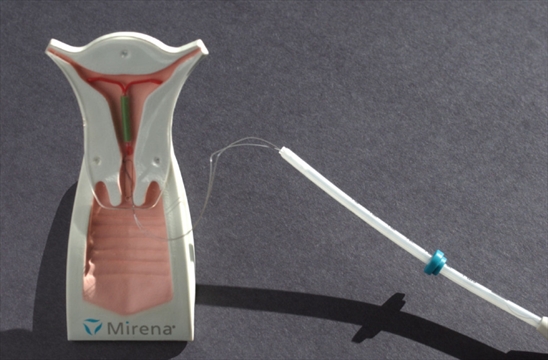 Why More Women Are Choosing The Iud 3183