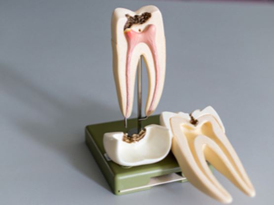 root canal tooth hurts to touch