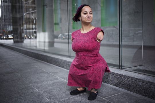 Talli Osborne Born Without Full Arms Or Legs Inspires Punk Rockers And Tedxtoronto Attendees 6505